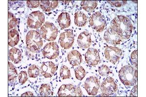Immunohistochemical analysis of paraffin-embedded stomach tissues using CA9 mouse mAb with DAB staining.