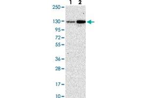 Western blot analysis of Lane 1: Human cell line RT-4 Lane 2: Human cell line U-251MG with CGNL1 polyclonal antibody  at 1:250-1:500 dilution.