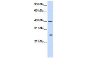 Image no. 1 for anti-Glutathione S-Transferase kappa 1 (GSTK1) (AA 36-85) antibody (ABIN6743827) (GSTK1 anticorps  (AA 36-85))