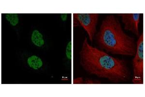 ICC/IF Image Confocal immunofluorescence analysis (Olympus FV10i) of paraformaldehyde-fixed U2OS, using NuMA, antibody (Geen) at 1:500 dilution.