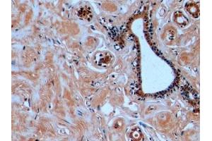 Detection of TUBb in Human Mammary gland Tissue using Monoclonal Antibody to Tubulin Beta (TUBb) (TUBB anticorps  (AA 170-419))