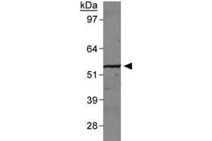 Western blot analysis of SLC2A9 in human kidney membrane with SLC2A9 polyclonal antibody . (SLC2A9 anticorps  (AA 500-550))