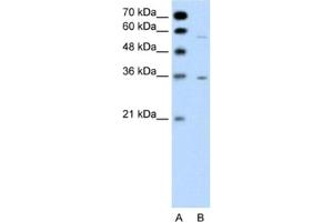 Western Blotting (WB) image for anti-G Protein-Coupled Receptor, Family C, Group 5, Member A (GPRC5A) antibody (ABIN2462428) (GPRC5A anticorps)