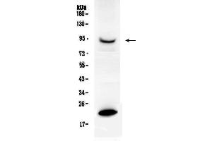 Western blot analysis of PRLR using anti- PRLR antibody .