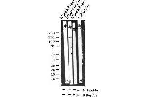 Western blot analysis of Phospho-GRF-1 (Tyr1105) expression in various lysates