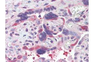 IHC Image for AP22893PU-N Placenta, Human: Formalin-Fixed, Paraffin-Embedded (FFPE)