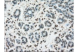 Image no. 1 for anti-Sjogren Syndrome Antigen B (SSB) antibody (ABIN1501146)