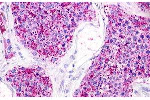 Image no. 1 for anti-Lysophosphatidic Acid Receptor 5 (LPAR5) (C-Term) antibody (ABIN1049019) (LPAR5 anticorps  (C-Term))