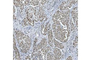 IHC analysis of TRMT6 using anti-TRMT6 antibody (ABIN7602138). (TRMT6 anticorps  (AA 6-489))