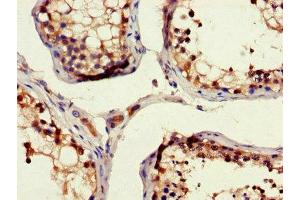 Immunohistochemistry of paraffin-embedded human testis tissue using ABIN7150275 at dilution of 1:100 (RAD54B anticorps  (AA 1-167))