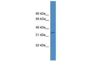 WB Suggested Anti-ELMOD1 Antibody Titration: 0. (ELMOD1 anticorps  (Middle Region))