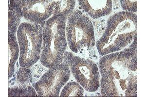 Image no. 2 for anti-Cyclin-Dependent Kinase Inhibitor 2B (p15, Inhibits CDK4) (CDKN2B) antibody (ABIN1497445) (CDKN2B anticorps)