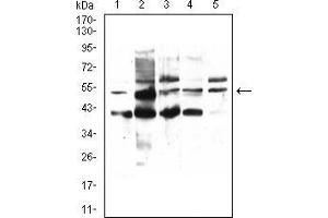 Western blot analysis using PPARA mouse mAb against HepG2 (1), HEK293 (2), COS7 (7), HepG2 (4), and Jurkat (5) cell lysate.