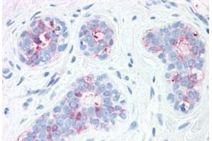 Immunohistochemistry (Formalin/PFA-fixed paraffin-embedded sections) of human breast with SYNGR2 polyclonal antibody . (SYNGR2 anticorps  (Internal Region))