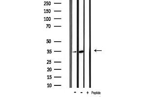 Western blot analysis of CDK5 phosphorylation expression in mouse brain and mouse muscle cells,The lane on the right was treated with the antigen-specific peptide.