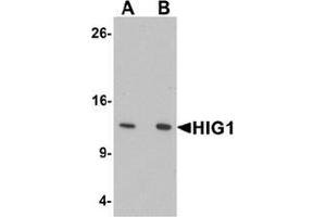 Western blot analysis of HIG1 in 293 cell lysate with HIG1 Antibody  at at (A) 0. (HIGD1A anticorps  (N-Term))