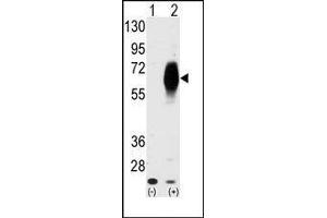 Western blot analysis of AMHR2 (arrow) using AMHR2 Antibody (AMHR2 anticorps  (N-Term))