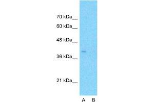 Host:  Rabbit  Target Name:  APOBEC3B  Sample Type:  HepG2  Lane A:  Primary Antibody  Lane B:  Primary Antibody + Blocking Peptide  Primary Antibody Concentration:  1ug/ml  Peptide Concentration:  5ug/ml  Lysate Quantity:  25ug/lane/lane  Gel Concentration:  0. (APOBEC3B anticorps  (N-Term))