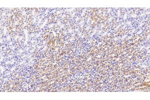 Detection of SDHB in Mouse Kidney Tissue using Polyclonal Antibody to Succinate Dehydrogenase Complex Subunit B (SDHB) (SDHB anticorps  (AA 97-282))