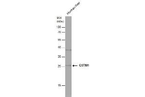 WB Image Human tissue extract (30 μg) was separated by 12% SDS-PAGE, and the membrane was blotted with GSTM1 antibody , diluted at 1:1000. (GSTM1 anticorps)