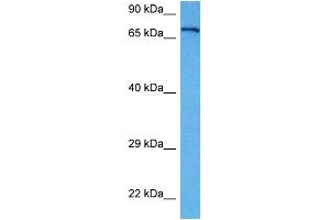 Host:  Rabbit  Target Name:  APP  Sample Tissue:  Human A172 Whole Cell lysates  Antibody Dilution:  1ug/ml (APP anticorps  (Middle Region))
