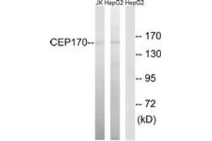 Western blot analysis of extracts from HepG2/Jurkat cells, using CEP170 Antibody. (CEP170 anticorps  (AA 701-750))