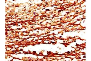 anti-Cystatin A (Stefin A) (CSTA) (AA 2-98) antibody