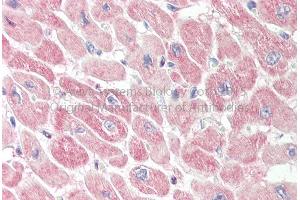 Rabbit Anti-RNH1 Antibody Catalog Number: ARP72880 Formalin Fixed Paraffin Embedded Tissue: Human Adult Heart  Observed Staining: Cytoplasm in hepatocytes Primary Antibody Concentration: 1:600 Secondary Antibody: Donkey anti-Rabbit-Cy3 Secondary Antibody Concentration: 1:200 Magnification: 20X Exposure Time: 0.