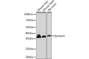 Western blot analysis of extracts of various cell lines, using Syntenin Rabbit mAb (ABIN7270680) at 1:1000 dilution. (SDCBP anticorps)