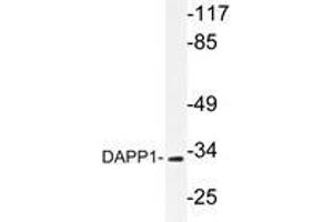 Western blot analysis of DAPP1 antibody in extracts from 293 cells. (DAPP1 anticorps)