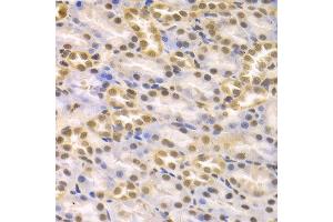 Immunohistochemistry of paraffin-embedded rat kidney using KDM1A antibody at dilution of 1:100 (x400 lens).