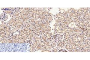 Immunohistochemistry of paraffin-embedded Rat kidney tissue using JAK2 Polyclonal Antibody at dilution of 1:200. (JAK2 anticorps)