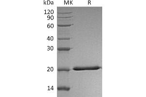 Interleukin 28A (Interferon, lambda 2) (IL28A) protein (His tag)