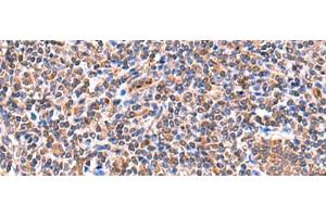 Immunohistochemistry of paraffin-embedded Human tonsil tissue using ISM1 Polyclonal Antibody at dilution of 1:60(x200) (ISM1 anticorps)