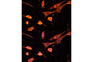 Immunofluorescence analysis of NIH-3T3 cells using BFAR Polyclonal Antibody (ABIN6127492, ABIN6137542, ABIN6137543 and ABIN6224322) at dilution of 1:100 (40x lens).