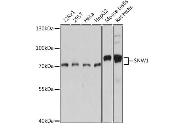 SNW1 Antikörper  (AA 300-536)