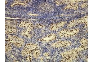 Immunohistochemistry (IHC) image for anti-Transcription Termination Factor, RNA Polymerase I (TTF1) (AA 97-110), (N-Term) antibody (ABIN870521)