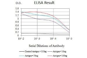 Black line: Control Antigen (100 ng),Purple line: Antigen (10 ng), Blue line: Antigen (50 ng), Red line:Antigen (100 ng)