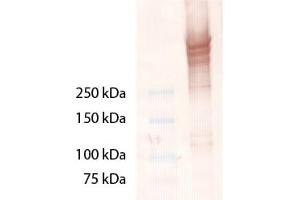 Western Blot analysis of Laminin 5. (Laminin 5 anticorps)
