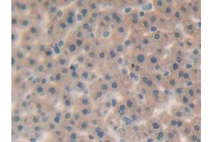 DAB staining on IHC-P; Samples: Rat Liver Tissue