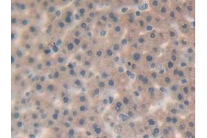 DAB staining on IHC-P; Samples: Rat Liver Tissue (IL-25 anticorps  (AA 33-169))