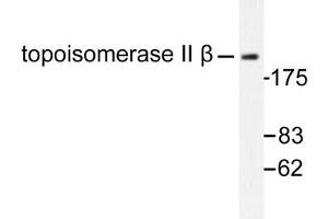Image no. 1 for anti-Topoisomerase (DNA) II beta 180kDa (TOP2B) antibody (ABIN271965)