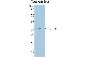 Western Blotting (WB) image for anti-Matrix Metallopeptidase 11 (Stromelysin 3) (MMP11) (AA 277-488) antibody (ABIN1078304) (MMP11 anticorps  (AA 277-488))