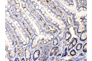 IHC testing of FFPE rat intestine tissue with Bax antibody at 1ug/ml.
