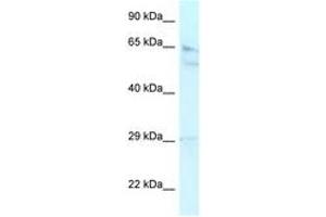 Image no. 1 for anti-Retinoblastoma Binding Protein 5 (RBBP5) (AA 324-373) antibody (ABIN6742442) (RBBP5 anticorps  (AA 324-373))