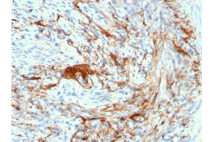 Formalin-fixed, paraffin-embedded human Small Intestine stained with Rabbit Recombinant Monoclonal Antibody (ELN/3131R) to Elastin. (Recombinant Elastin anticorps)