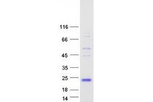 Validation with Western Blot