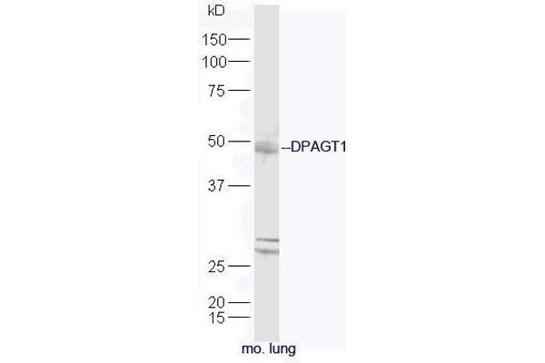DPAGT1 anticorps  (AA 301-408)