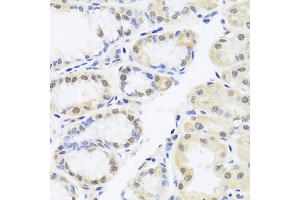 Immunohistochemistry of paraffin-embedded human stomach using RUNX1 antibody (ABIN6291786) at dilution of 1:100 (40x lens). (RUNX1 anticorps)