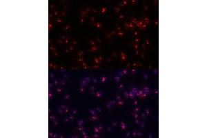 Immunofluorescence analysis of C6 cells using Fibrillarin/U3 RNP antibody (ABIN6130429, ABIN6140494, ABIN6140496 and ABIN6217509) at dilution of 1:100.